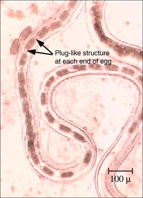 Figure 10. Capillaria female showing eggs with plug-like structures at each end.