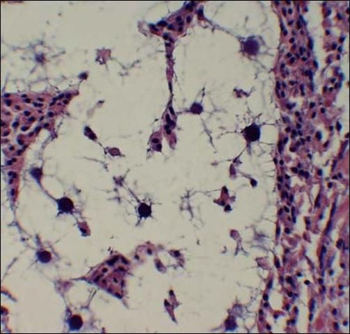 Figure 1. Photomicrograph of QPX, with halo-like area surrounding the parasites in hard clam (Mercenaria mercenaria) tissue Magnification 400X.