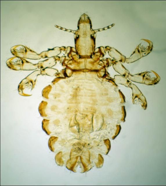 Figure 1. Hog louse.