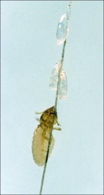 Figure 15. Horse biting louse on horse hair.