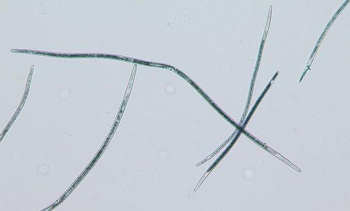 Figure 1. Sting nematode Belonolaimus longicaudatus.