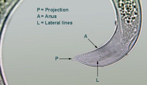 Figure 6. The tail of Helicotylenchus pseudorobustus is asymmetrical and has a projection on the end.