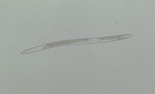 Figure 1. The body of Helicotylenchus spp. and other spiral nematodes curve into a spiral when the nematode is dead or relaxed. This moving nematode is outstretched.
