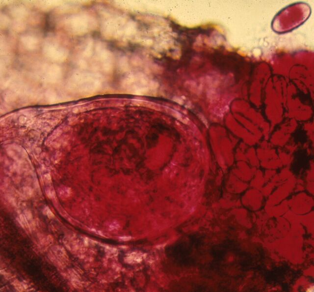 Figure 2. Adult female of the root-knot nematode (Meloidogyne sp.) with attached egg mass.