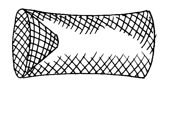 Figure 4. Funneled minnow trap for snakes.
