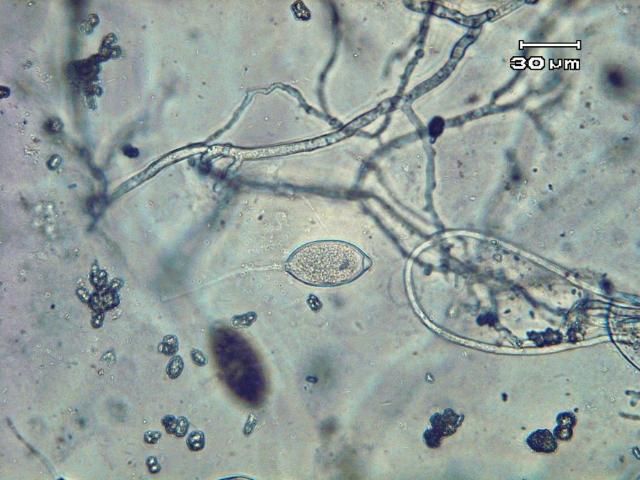 Figure 12. Lemon-shaped sporangium and thread-like mycelia of Phytophthora capsici.