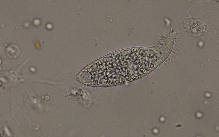 Figure 24. An elongated ciliate from fresh fecal material collected from D. antillarum from the Florida Keys. The organism may be Amphileptus punctatus (600x).